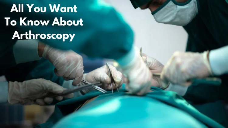 All You Want to Know About Arthroscopy